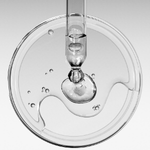 Hyaluronic Acid